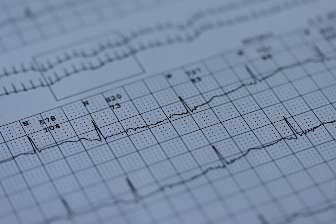 An ECG waveform signal on a monitor, representing the cardiac signal that wearables must filter and interpret to guess breathing patterns