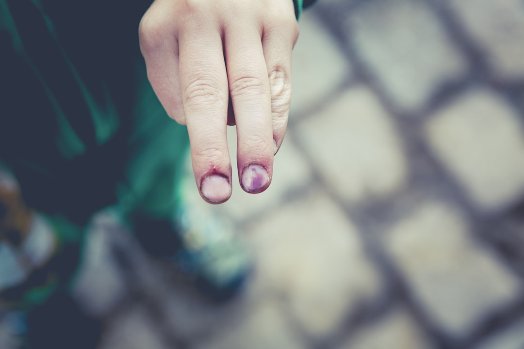 A close-up of hands showing blood vessels and skin texture, illustrating how finger blood flow changes during exercise
