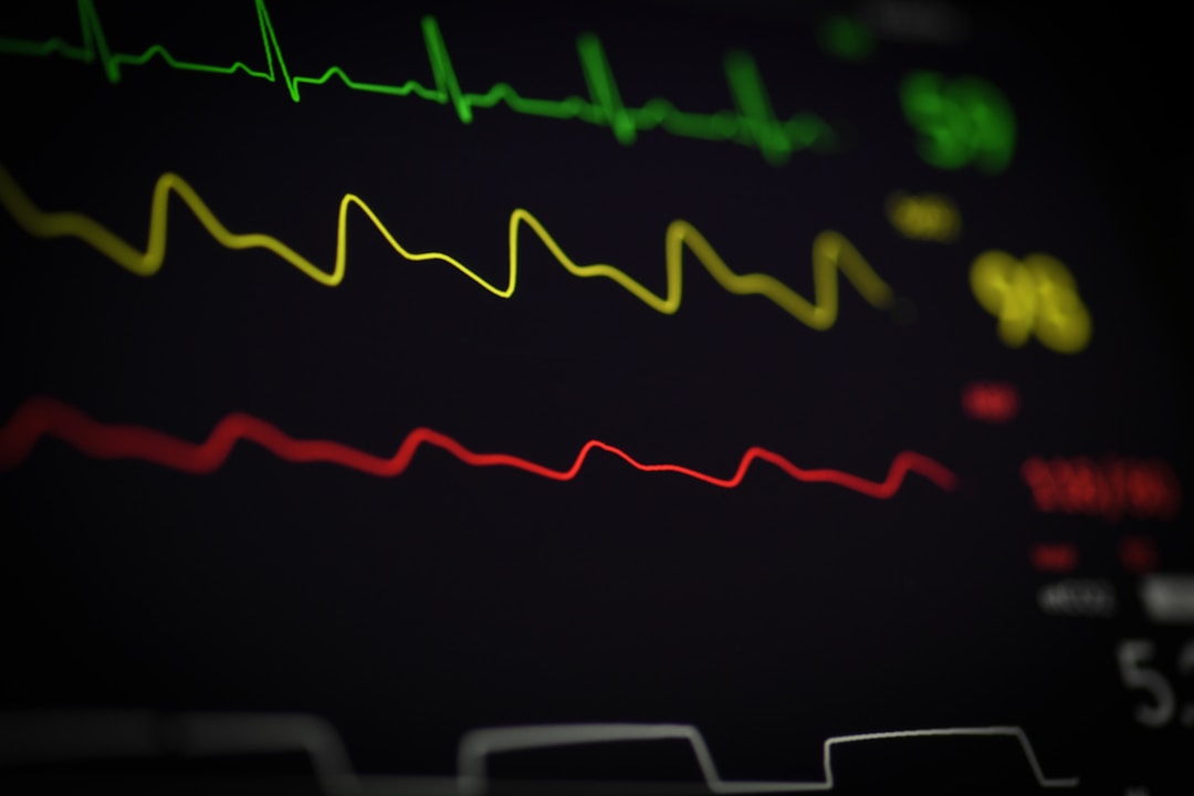 A close-up of an ECG monitor screen showing the characteristic electrical waveform of a heartbeat. Smart rings measure something completely different.