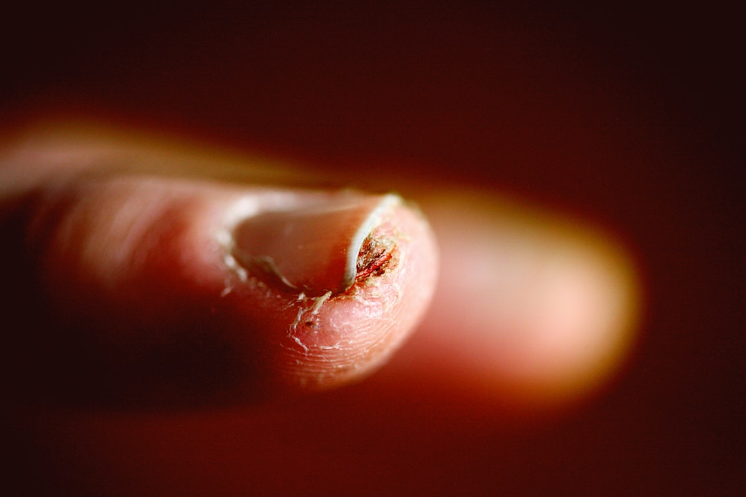 Macro photograph of finger skin showing the dense capillary network near the surface. The biological reason transmissive PPG works better at the fingertip than the wrist.